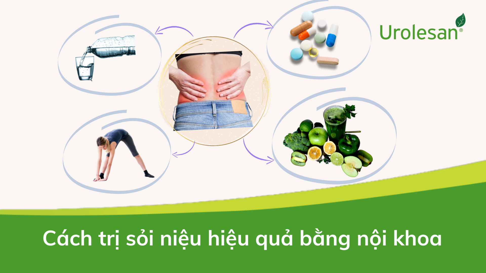 Cách trị sỏi niệu hiệu quả bằng nội khoa